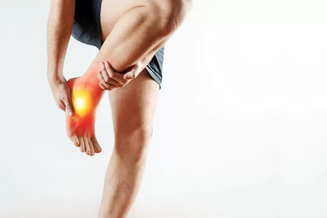 Edema articular y su tratamiento con gel de Congelum