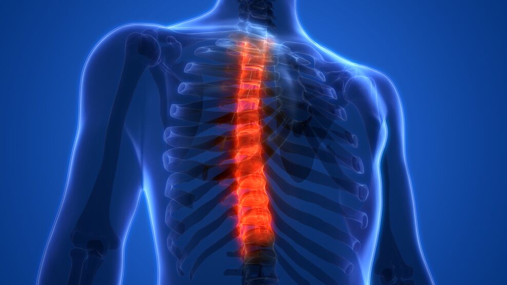 Osteocondrosis de la columna torácica.